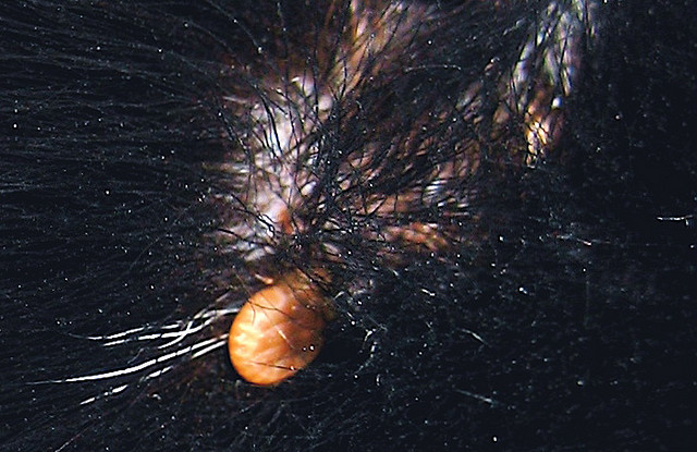 Cochez la case sur le corps de la victime