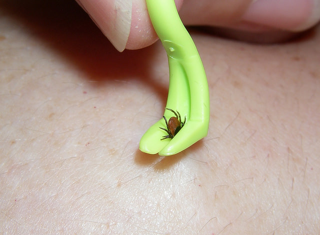 Pince spéciale pour retirer les tiques