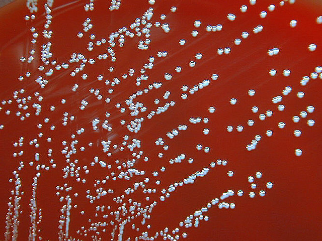 L'agent causal de la brucellose