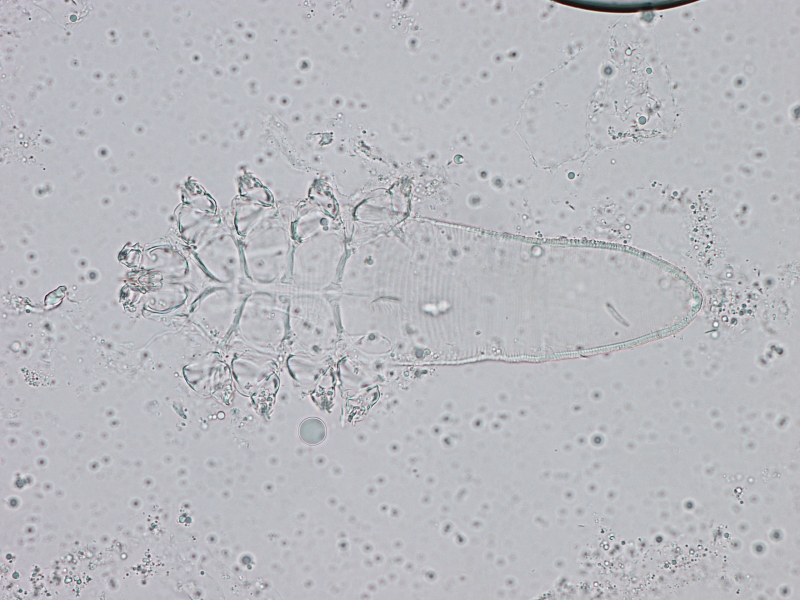 Demodex