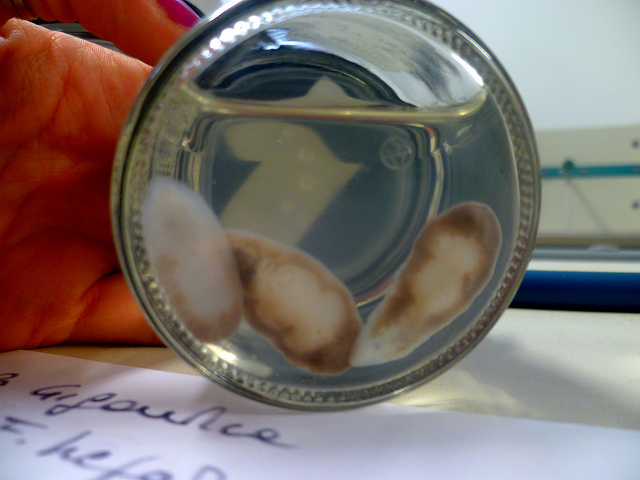 Fasciola gigantica est l'agent causal de la fasciolose.