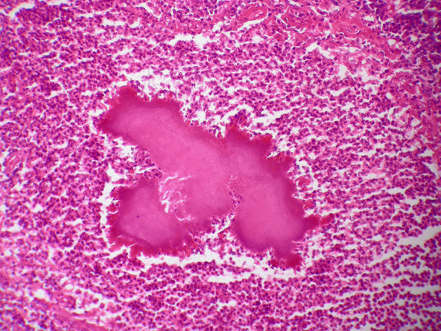 Modifications pathomorphologiques des tissus