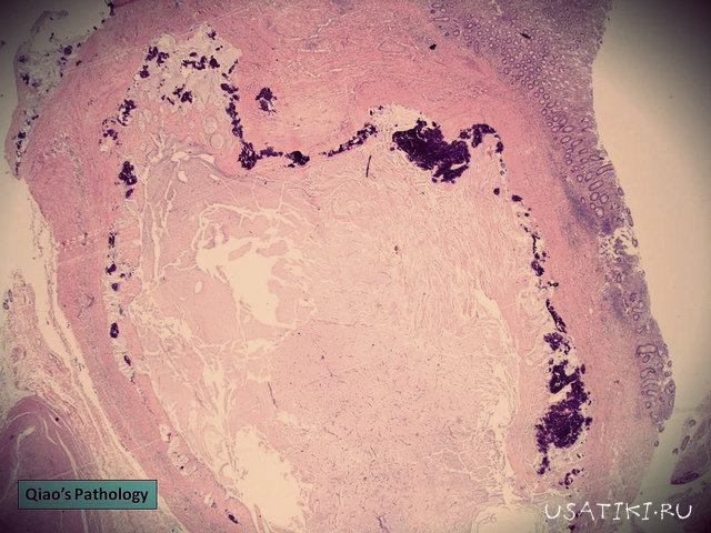 Microscopie tissulaire
