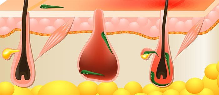 La démodécie chez les chats