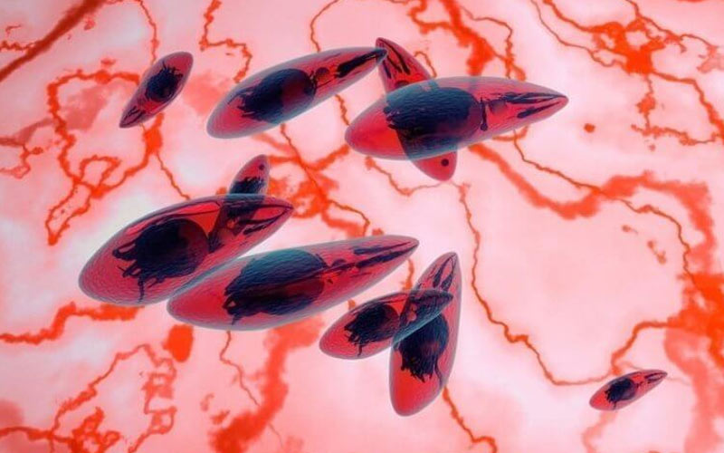 Toxoplasmose - symptômes, traitement, modes de transmission