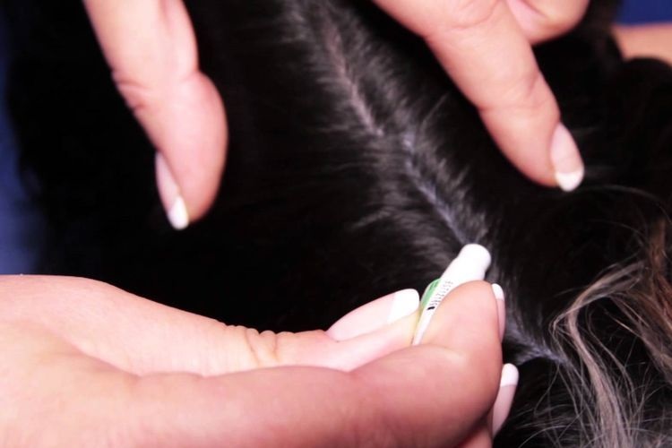 Des gouttes sont déposées sur le garrot du chien.