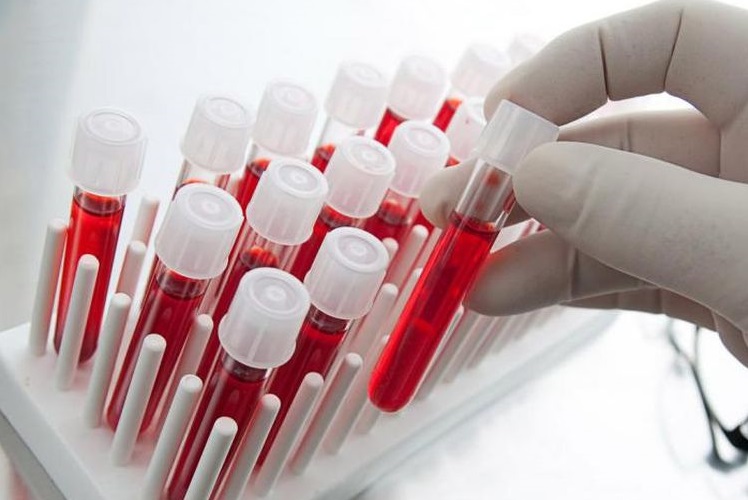 Tubes à essai contenant du sang