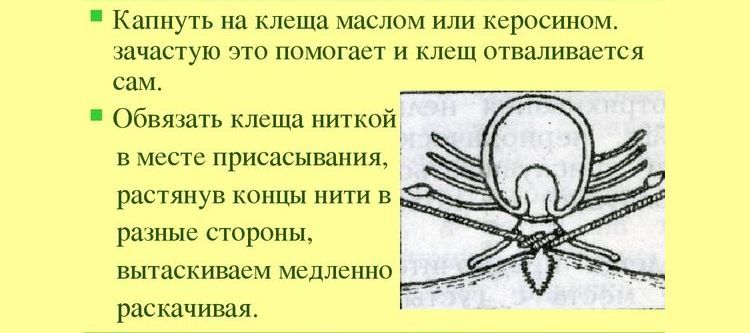 Enlever une tique avec un fil