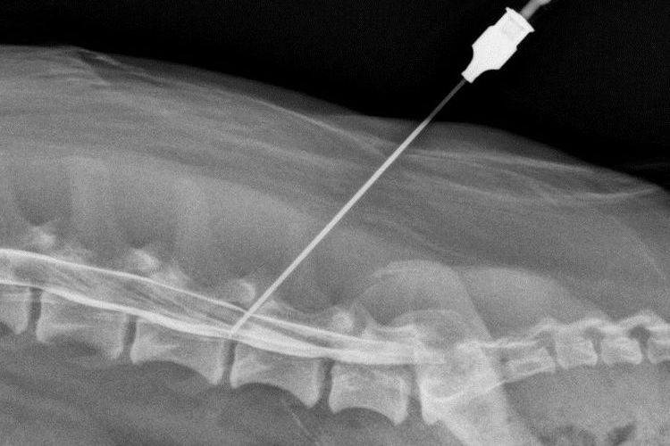 Radiographie de la colonne vertébrale