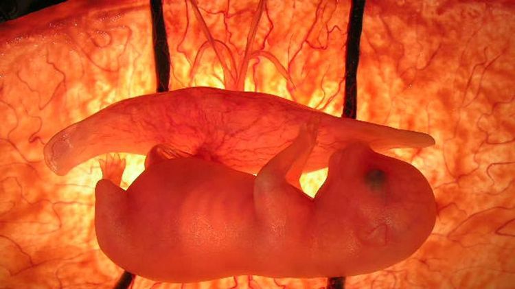 Échographie d'une chienne gestante