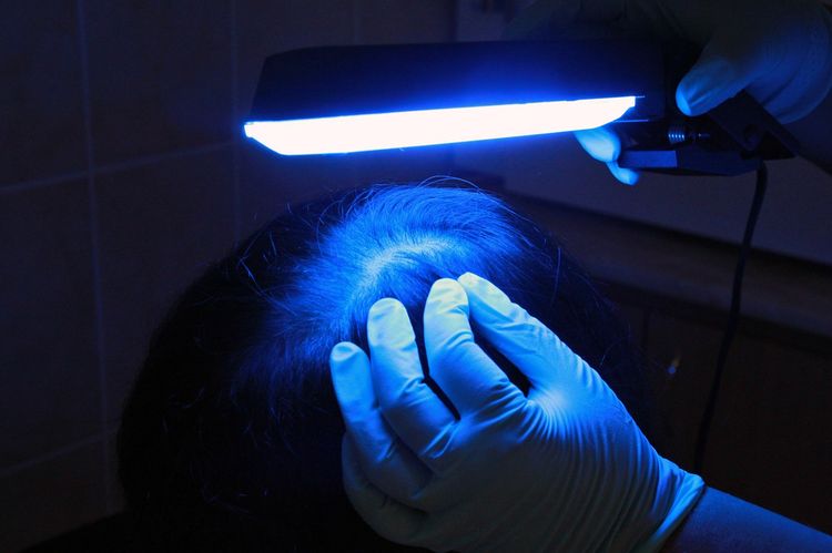 Examen à la lampe de Wood