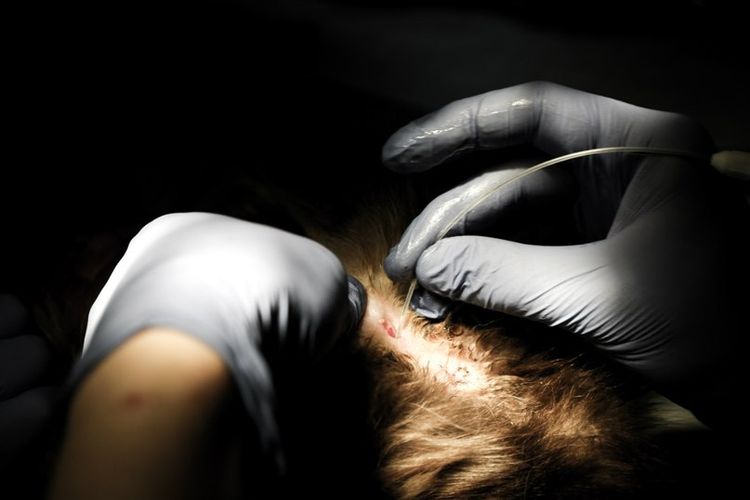 Une opération chirurgicale pour un chat