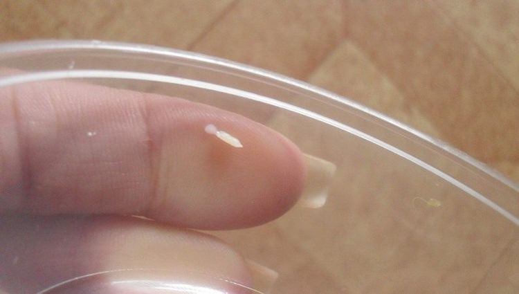 Photo de larves de ténia du concombre