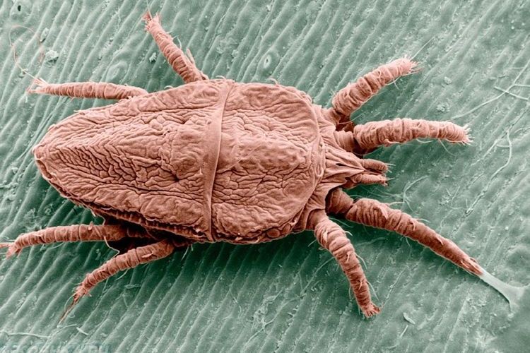 L'acarien de la gale Sarcoptes scabiei
