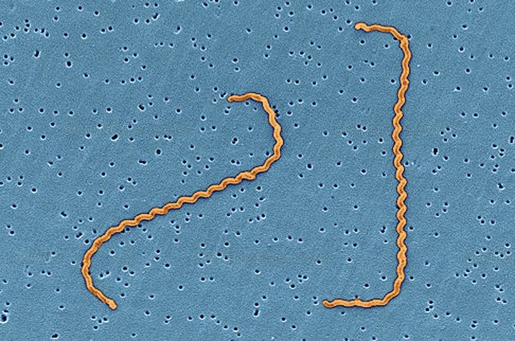 Leptospira interroge