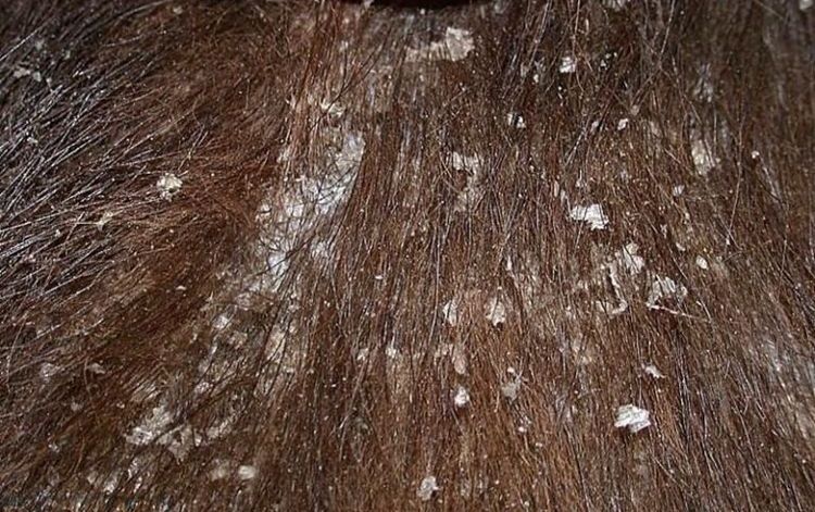 Cheyletiella chez les chiens