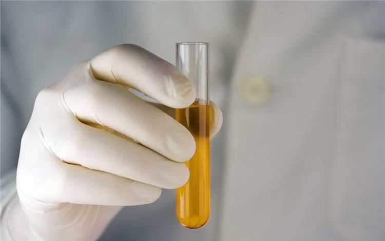 Urine de chien dans un tube à essai