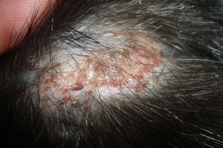 Trichophytose chez le chien