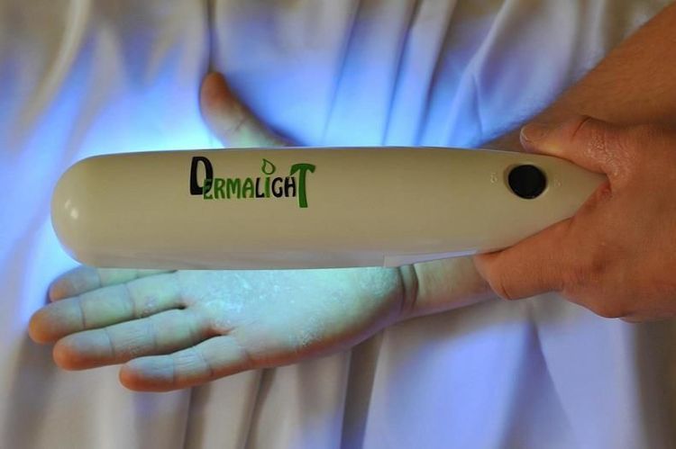 Traitement du pityriasis rosé par la lumière ultraviolette