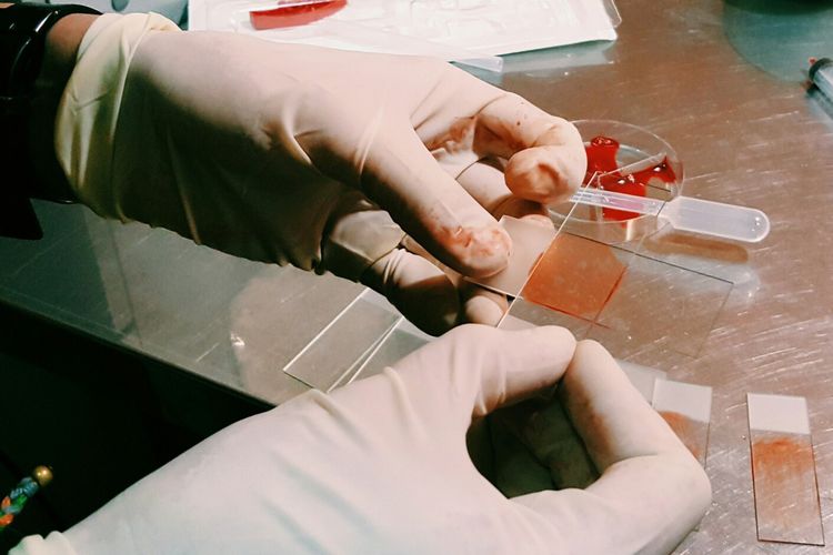 Analyses en laboratoire