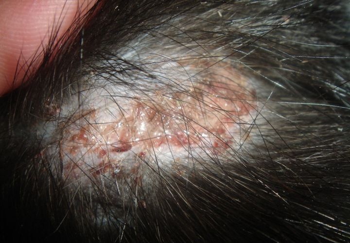 Trichophytose chez un chien