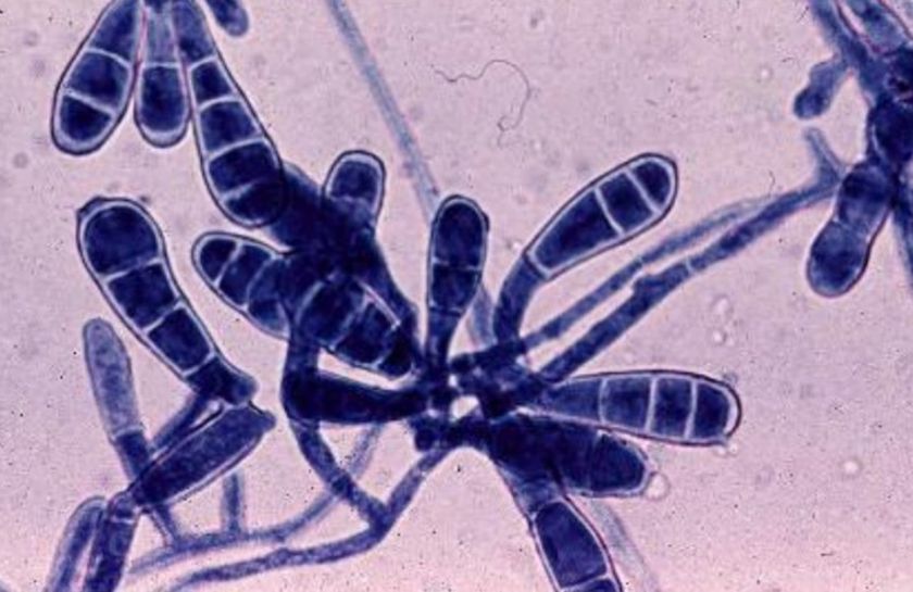 L'agent causal de la dermatophytose