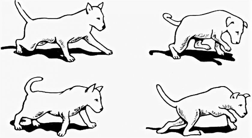 Exemples de démarche dans l'ataxie