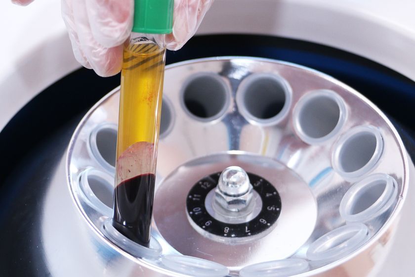 Du sang pour analyse