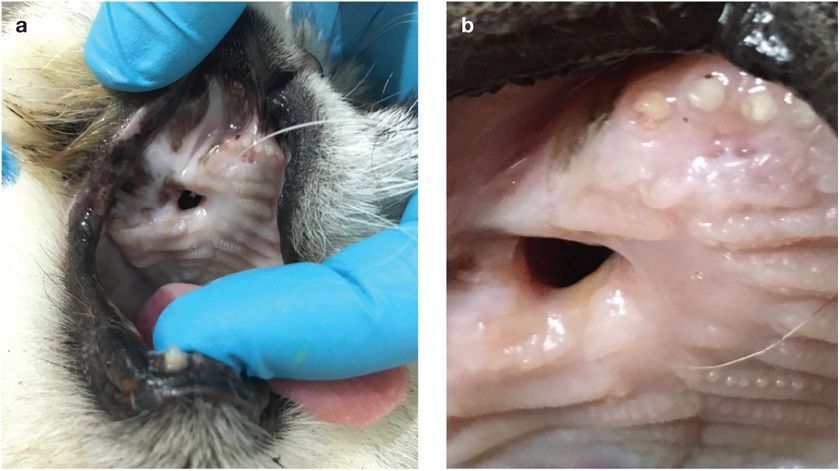 Fistule dans la bouche