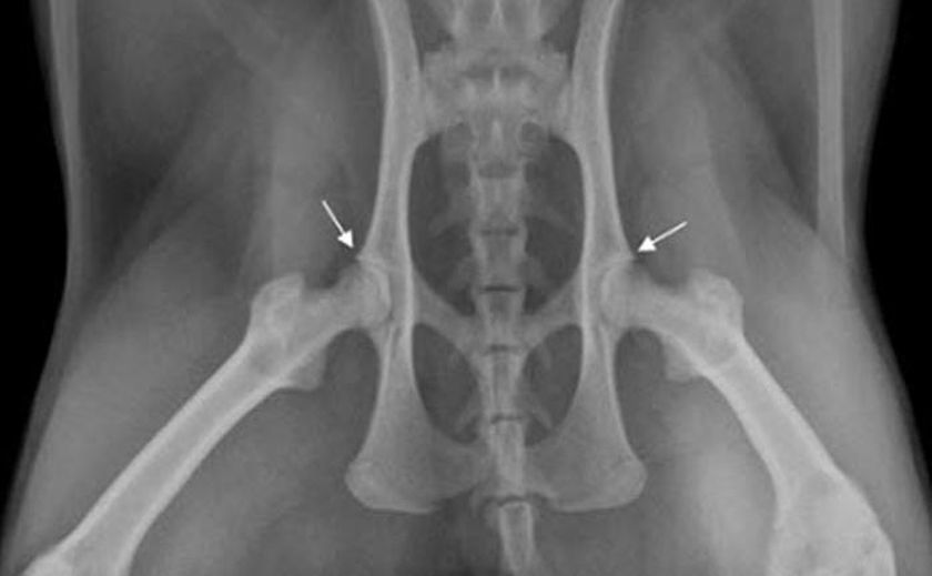 Radiographie du bassin