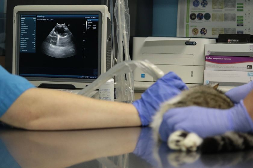 échographie cardiaque