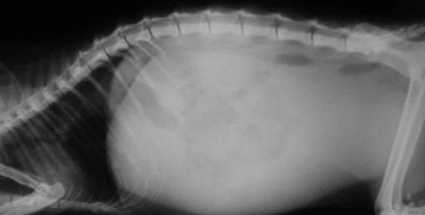 Radiographie de la cavité abdominale