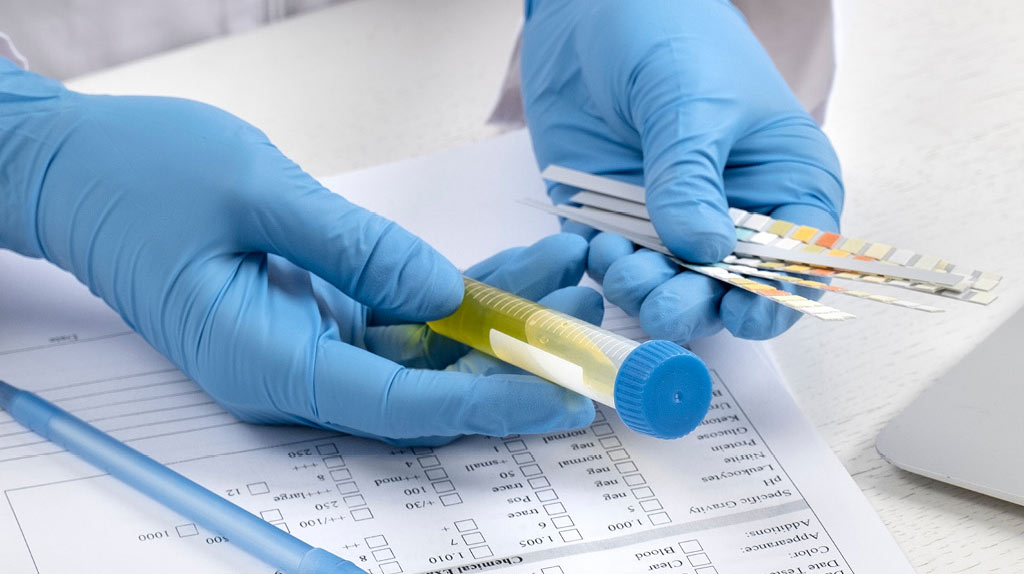 Règles de prélèvement d'urine chez les chats pour analyse