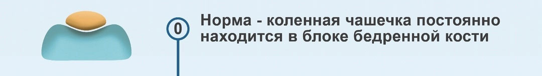 Position normale de la rotule