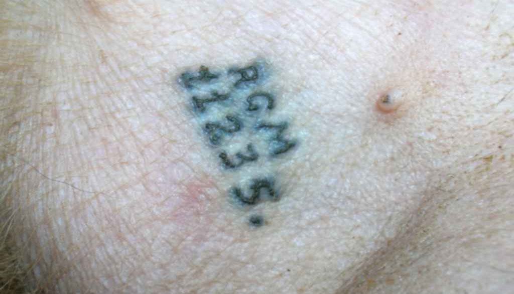 Une marque sur le ventre d'un chien